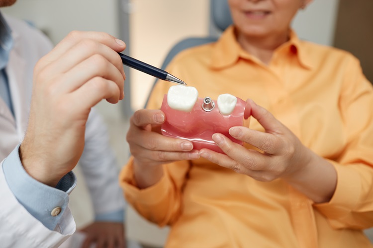 How Dental Implants Help in Proper Chewing
